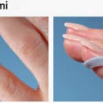 Multi Finger Splint -sormilasta